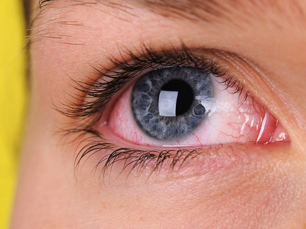 Probable-Causes-And-Solutions-To-Contact-Lens-Irritation